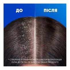 Шампунь Head & Shoulders Цитрусовая свежесть 400 мл Фото 3
